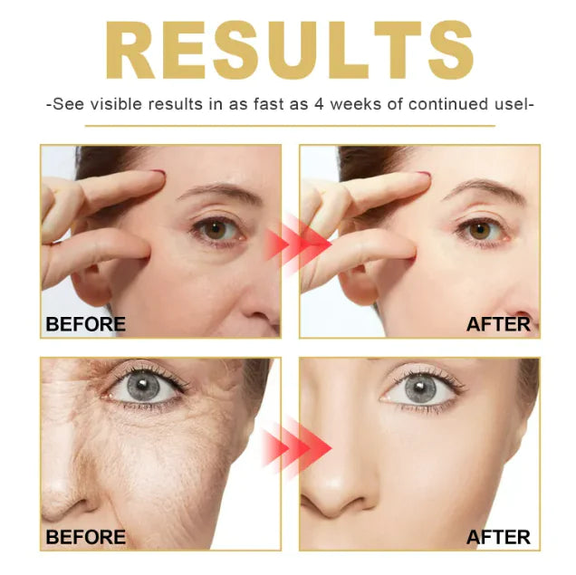 AlluraOne™ Moisturizing Anti-Wrinkle Skin Cream