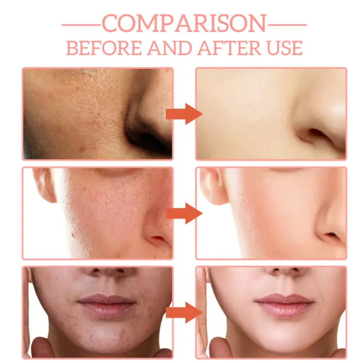 AlluraOne™   YouthMax 5-in-1 Rejuvenating Serum